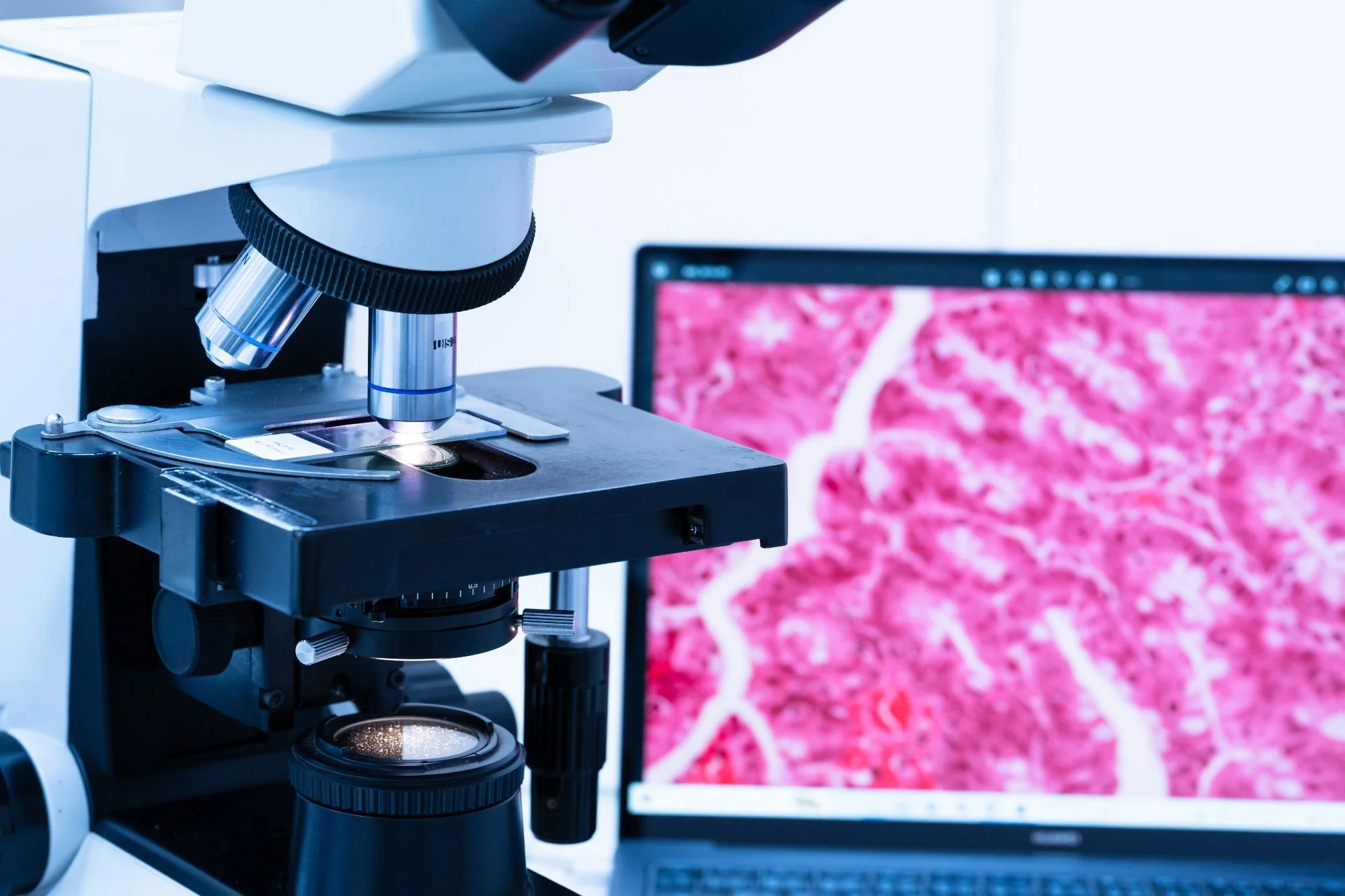 Histopathological Evaluation